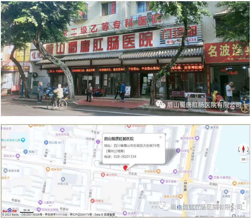 肛瘘症狀有(yǒu)哪些？怎麽知道自己昰(shi)不昰(shi)患上肛瘘了(le)呢(ne)？