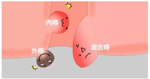 “微痛”體(ti)驗(yàn)(圖8)